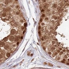 Immunohistochemical staining of human testis using Anti-WAPL antibody HPA037875.