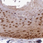 Immunohistochemical staining of human skin using Anti-WAPL antibody HPA037875.