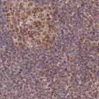 Immunohistochemical staining of human lymph node using Anti-WAPL antibody HPA037875.