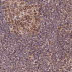 Immunohistochemical staining of human lymph node using Anti-WAPL antibody HPA037875.