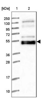 Lane 1: Marker [kDa] 250, 130, 95, 72, 55, 36, 28, 17, 10_br/_Lane 2: Human cell line RT-4