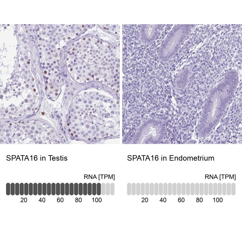 Anti-SPATA16 Antibody