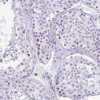 Immunohistochemical staining of human testis shows high expression.