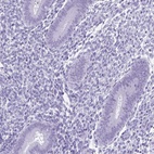 Immunohistochemical staining of human endometrium shows low expression as expected.