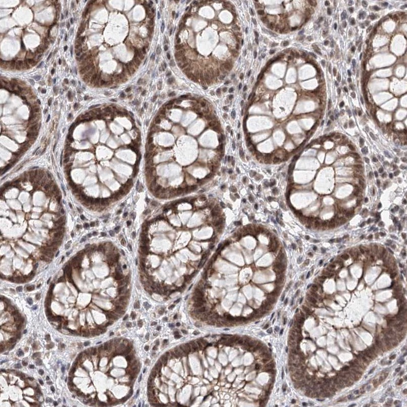 Anti-FAM13C Antibody