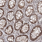 Anti-FAM13C Antibody