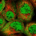 Immunofluorescent staining of human cell line A-431 shows localization to nucleoplasm & cytosol.
