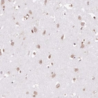 Immunohistochemical staining of human cerebral cortex shows moderate positivity in neurons.
