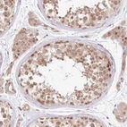 Immunohistochemical staining of human testis shows moderate positivity in cells in seminiferous ducts.