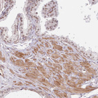 Immunohistochemical staining of human prostate shows moderate positivity in glandular and smooth muscle cells.
