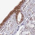 Anti-SIMC1 Antibody