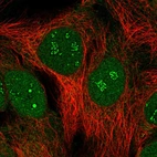 Immunofluorescent staining of human cell line CACO-2 shows localization to nucleus & nucleoli fibrillar center.
