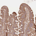 Immunohistochemical staining of human small intestine shows moderate cytoplasmic positivity in glandular cells.