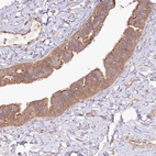 Immunohistochemical staining of human Fallopian tube shows moderate cytoplasmic positivity in glandular cells.