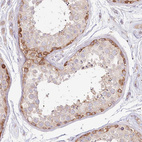 Immunohistochemical staining of human Testis shows moderate cytoplasmic positivity in cells in seminiferous ducts.