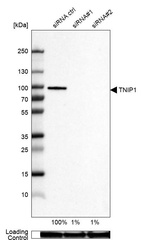 Western blot analysis in U-87MG ATCC cells transfected with control siRNA, target specific siRNA probe #1 and #2, using Anti-TNIP1 antibody. Remaining relative intensity is presented. Loading control: Anti-GAPDH.