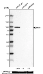 Western blot analysis in U-87MG ATCC cells transfected with control siRNA, target specific siRNA probe #1 and #2, using Anti-TNIP1 antibody. Remaining relative intensity is presented. Loading control: Anti-GAPDH.