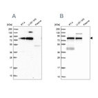 Western blot analysis using Anti-TNIP1 antibody HPA037893 (A) shows similar pattern to independent antibody HPA037894 (B).