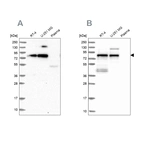 Western blot analysis using Anti-TNIP1 antibody HPA037893 (A) shows similar pattern to independent antibody HPA037894 (B).