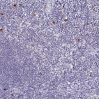 Anti-TNIP1 Antibody