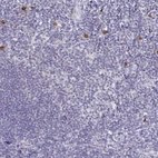 Anti-TNIP1 Antibody