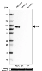 Western blot analysis in U-87MG ATCC cells transfected with control siRNA, target specific siRNA probe #1 and #2, using Anti-TNIP1 antibody. Remaining relative intensity is presented. Loading control: Anti-GAPDH.
