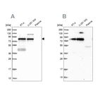 Western blot analysis using Anti-TNIP1 antibody HPA037894 (A) shows similar pattern to independent antibody HPA037893 (B).