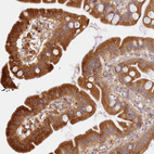 Immunohistochemical staining of human small intestine shows strong cytoplasmic positivity in glandular cells.