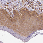 Immunohistochemical staining of human skin shows moderate cytoplasmic positivity in squamous epithelial cells.