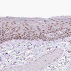 Immunohistochemical staining of human skin shows weak to moderate nuclear positivity in squamous epithelial cells.
