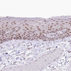 Immunohistochemical staining of human skin shows weak to moderate nuclear positivity in squamous epithelial cells.