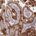 Anti-NSUN2 Antibody