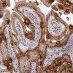 Immunohistochemical staining of human duodenum shows moderate nuclear and cytoplasmic positivity in glandular cells.