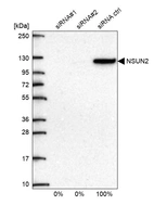 Western blot analysis in U2OS cells transfected with control siRNA, target specific siRNA probe #1 and #2, using Anti-NSUN2 antibody. Remaining relative intensity is presented.