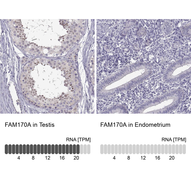 Anti-FAM170A Antibody