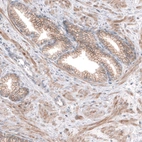 Immunohistochemical staining of human prostate shows moderate membranous positivity in glandular cells.