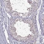 Anti-FAM170A Antibody