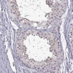 Immunohistochemical staining of human testis shows high expression.
