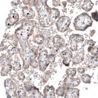 Immunohistochemical staining of human placenta shows weak to moderate membranous and cytoplasmic positivity in trophoblastic cells.