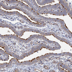 Anti-IFT46 Antibody
