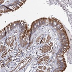 Anti-IFT46 Antibody