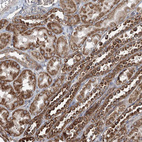 Immunohistochemical staining of human kidney shows strong granular cytoplasmic positivity in cells in tubules.