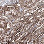 Immunohistochemical staining of human kidney shows strong granular cytoplasmic positivity in cells in tubules.