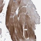 Immunohistochemical staining of human skeletal muscle shows moderate cytoplasmic positivity in myocytes.