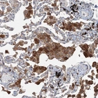 Immunohistochemical staining of human lung shows moderate cytoplasmic positivity in macrophages.