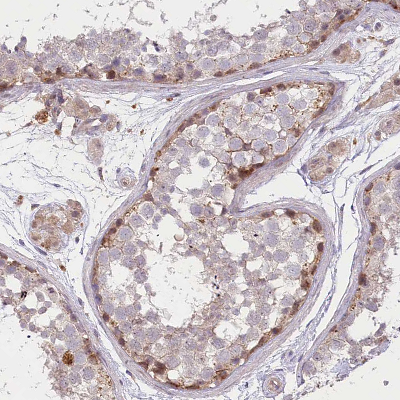 Anti-TRUB1 Antibody