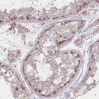 Anti-TRUB1 Antibody