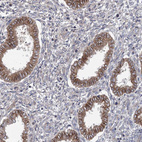 Immunohistochemical staining of human endometrium shows moderate cytoplasmic positivity in glandular cells.