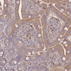 Immunohistochemical staining of human duodenum shows moderate cytoplasmic positivity in glandular cells.
