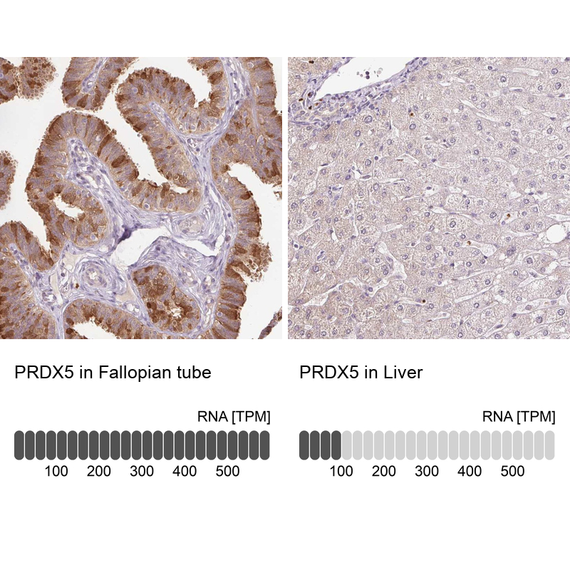 Anti-PRDX5 Antibody